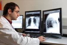 Angiogram